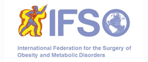 ifso